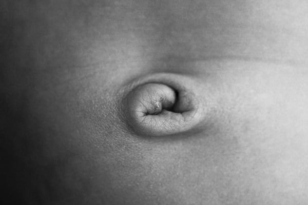 Extreme close-up of a newborn's navel with the healing cord stump, in black and white